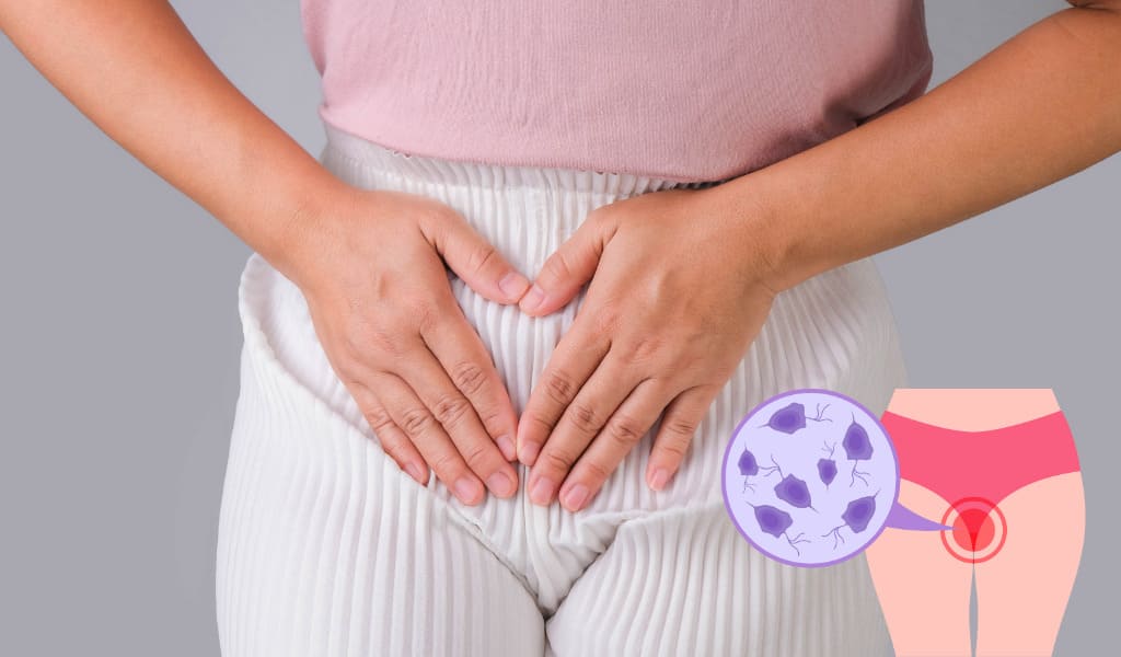 Benefits Of Goldenseal For BV