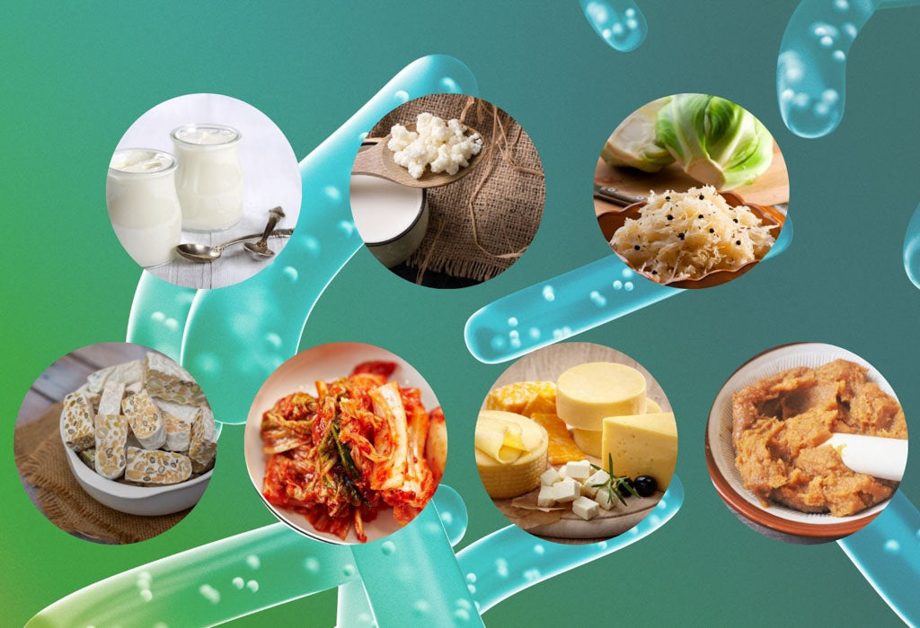 foods with lactobacillus acidophilus