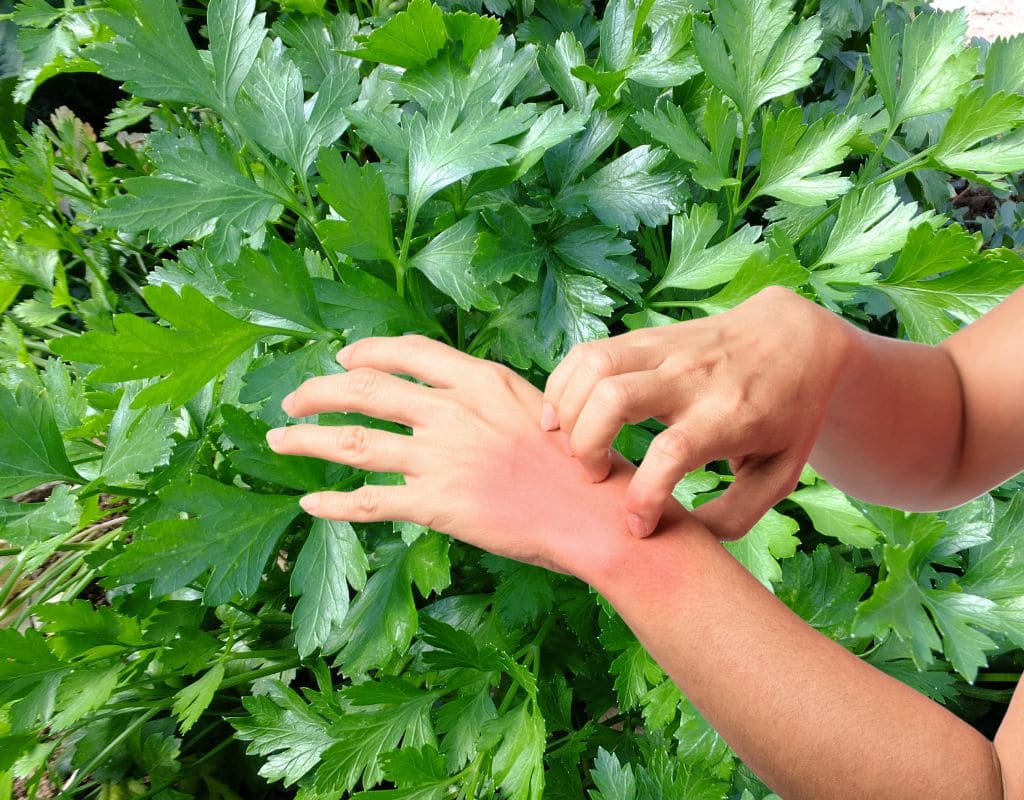 Can You Be Allergic to Parsley