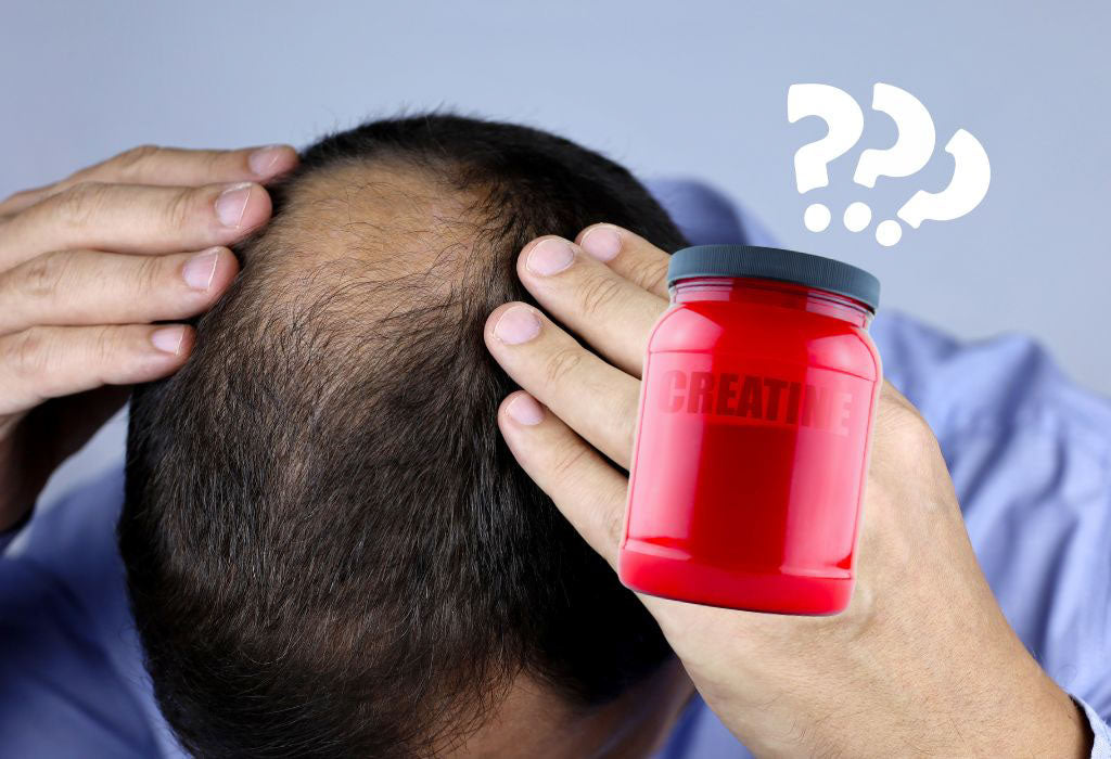 Does Creatine Cause Hair Loss