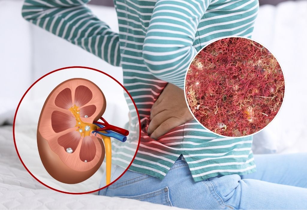 is sea moss good for kidneys