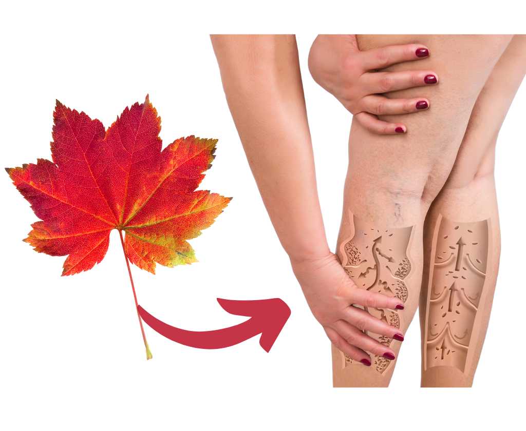 red vine leaf extract for varicose veins