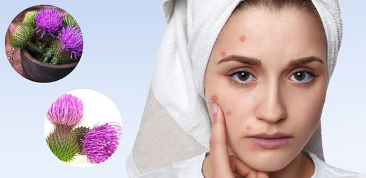 benefits of milk thistle for acne