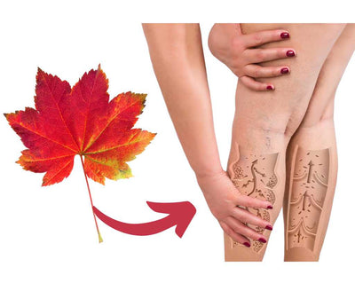 red vine leaf extract for varicose veins