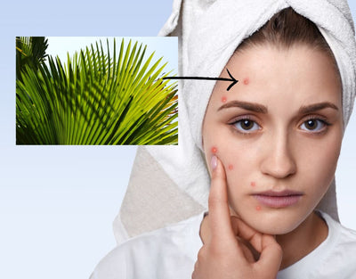 Saw Palmetto For Acne And Skin Health